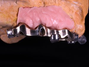 Manufacturing Stage: Gold milled bar.