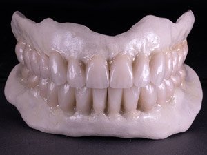 Manufacturing Stage: Pekkton frames with Lithium Disilicate on HexScan pillars.