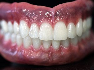 Finished Stage: The case ready to fit.